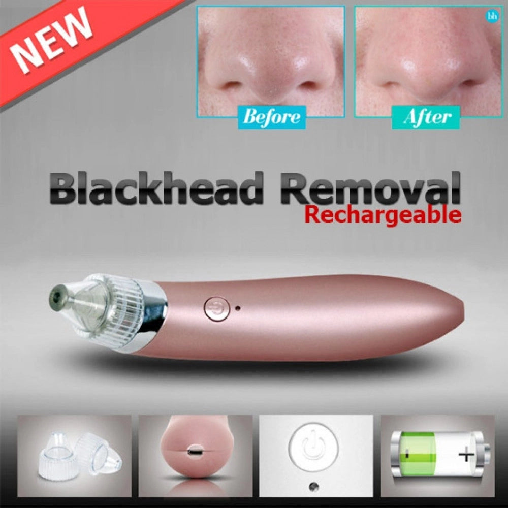 Trade Shop - Aspiratore Rimuovere Punti Neri Ad Ultrasuoni Pulizia Viso Facciale Portatile -