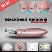 Trade Shop - Aspiratore Rimuovere Punti Neri Ad Ultrasuoni Pulizia Viso Facciale Portatile -