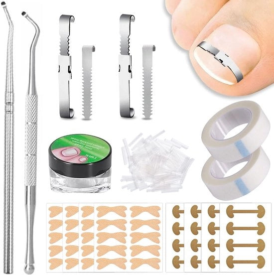 Set di correttura unghie integrate 212 pezzi - Correttura unghie - Trimmer unghie - Adesivo per unghie - Adesivi per correttura - Cura dei piedi - Correttura unghie per bambini
