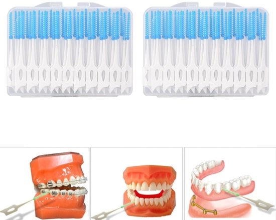 Set di Spazzolini Interdentali da 80 pezzi - Spazzolini da Denti Interdentali da Lasciare - Spazzolini Interdentali Zucchero - Materiale Sicuro per la Nutrizione - Materiale Amichevole con l'ambiente - Facile da Utilizzare e Pulito