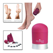 Trade Shop - Elettrico Viakallo Pedi Pro Deluxe Pedicure Piedi Via Callo E Duroni Pedicure -