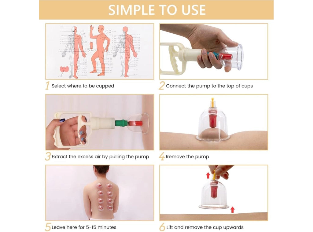 Kit 12 Pezzi Coppettazione per Massaggio con Ventose Sottovuoto con Coppette Soluzione per la Salute e il Benessere