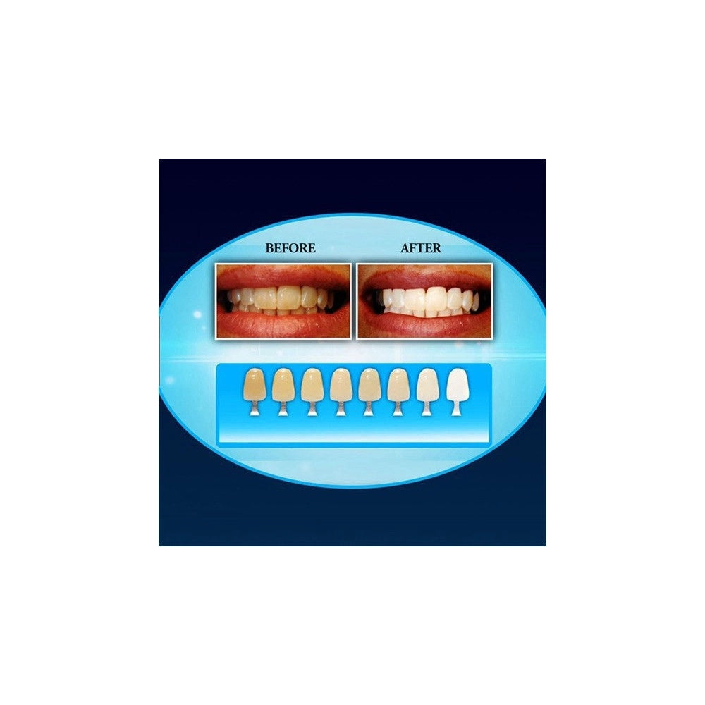 Trade Shop - Dispositivo Professionale Sbiancante A Led Denti Dental White Rx Sorriso Super -
