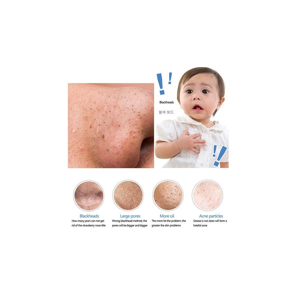 Trade Shop - Aspiratore Facciale Per La Pulizia Del Viso Da Punti Neri Acne E Impurità Hl-308 -