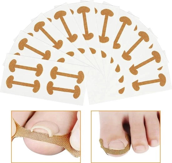 Correzione Stickers per Unghie Ingegnerate – 40 Unità – Correzione per Unghie Ingegnerate – Elastico e Transparente – Strisce di Correzione Pedicure