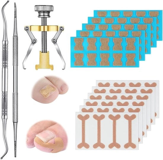 Correttore per unghie ingrossate - Kit di accessori composto da patch elastico, adesivi per correggere unghie curve, vijlatura per unghie e lifter per curvatura unghie