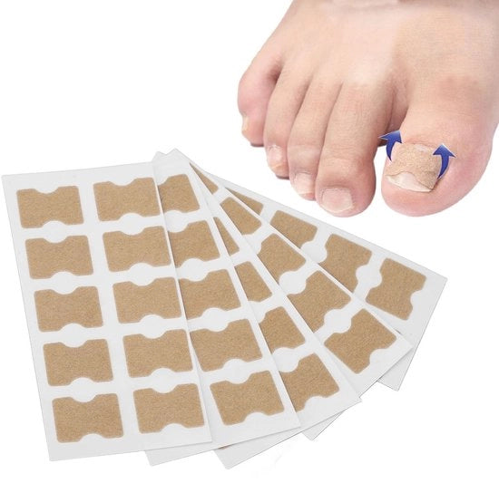 Correttore unghie a colla 50 pezzi - Trattamento unghie danneggiate - Senza dolore - Cura dei piedi - Design compatto - Utilizzo igienico - Correzione unghie danneggiate