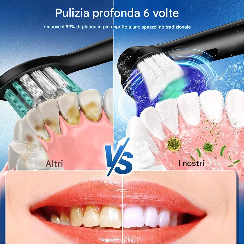 Spazzolino Elettrico Rotante con 4 Testine Intercambiabili e Timer Intelligente