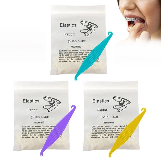 Elastici ortodontici multifunzionali 300 pezzi - apertura dentale - gomma - leggero - sicuro e non tossico - elastici per ortodonzia