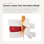 1.5 - Modello Anatomico - Modello di Demonstrazione - Colonna Vertebrale Lombare - Disco Intervertebrale Morbido - Modello Anatomico