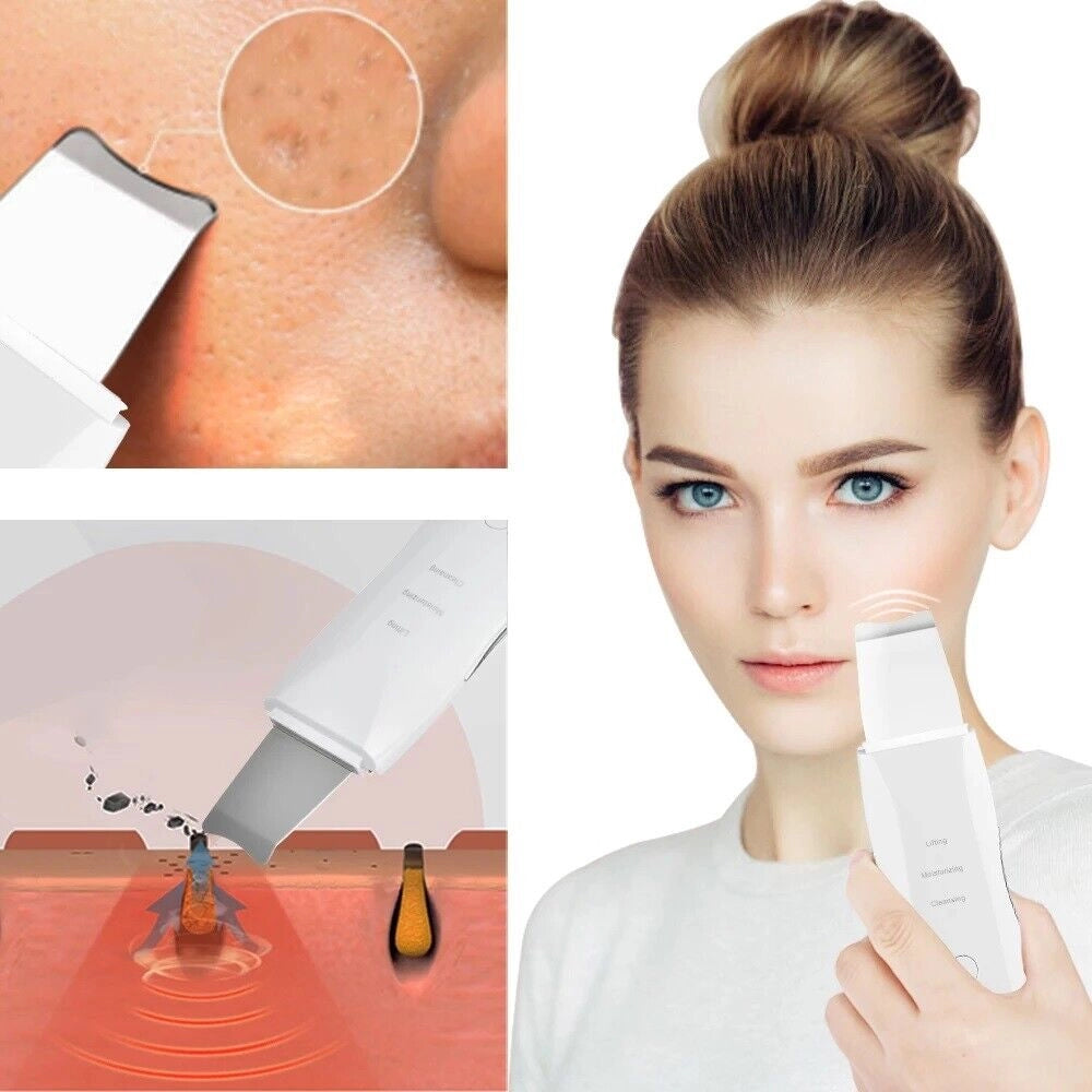 Spatola Ultrasuoni Pulizia Viso Pelle Elimina Punti Neri 3 funzioni