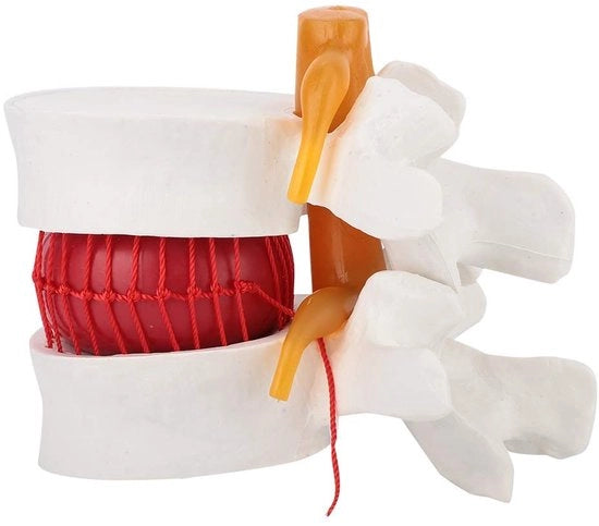 1.5 - Anatomia Modello - Modello di Demonstrazione - Colonna Vertebrale Lombare - Disco Intervertebrale Morbido - Modello Anatomico