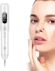 Rimozione pigmenti, penna plasma, rimozione macchie, rimozione macchie e pigmentazione da acne, sprogetti e piccole tatuaggi, 9 impostazioni regolabili, ricaricabile.