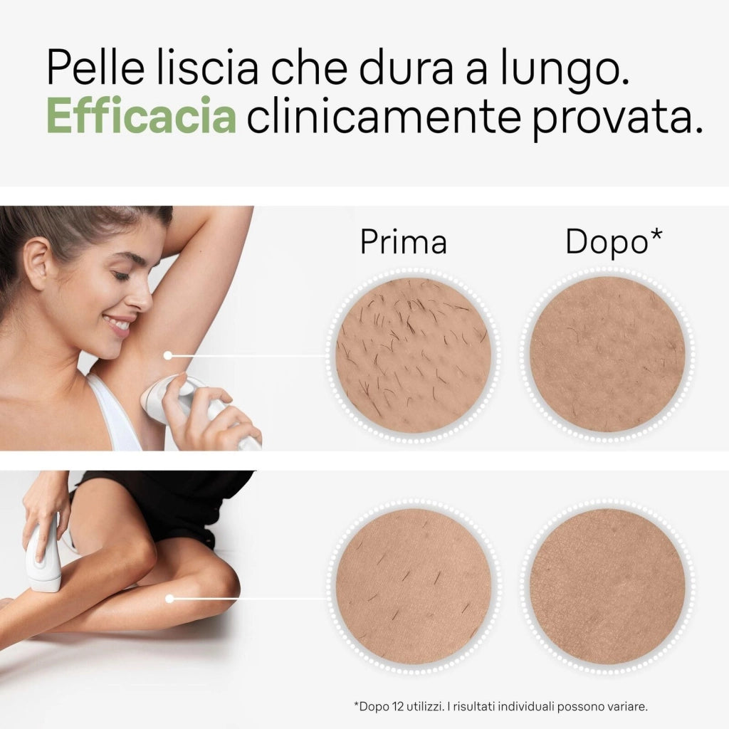 Braun Silk-expert Pro Silk expert Pro 3 PL3020, Epilatore A Luce Pulsata Donna, Per La Rimozione Permanente Dei Peli Visibili A Casa Tua, Bianco/Argento