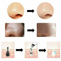 ASPIRA ELIMINA RIMUOVI PUNTI NERI PULIZIA VISO BRUFOLI A BATTERIE PORI NASALI