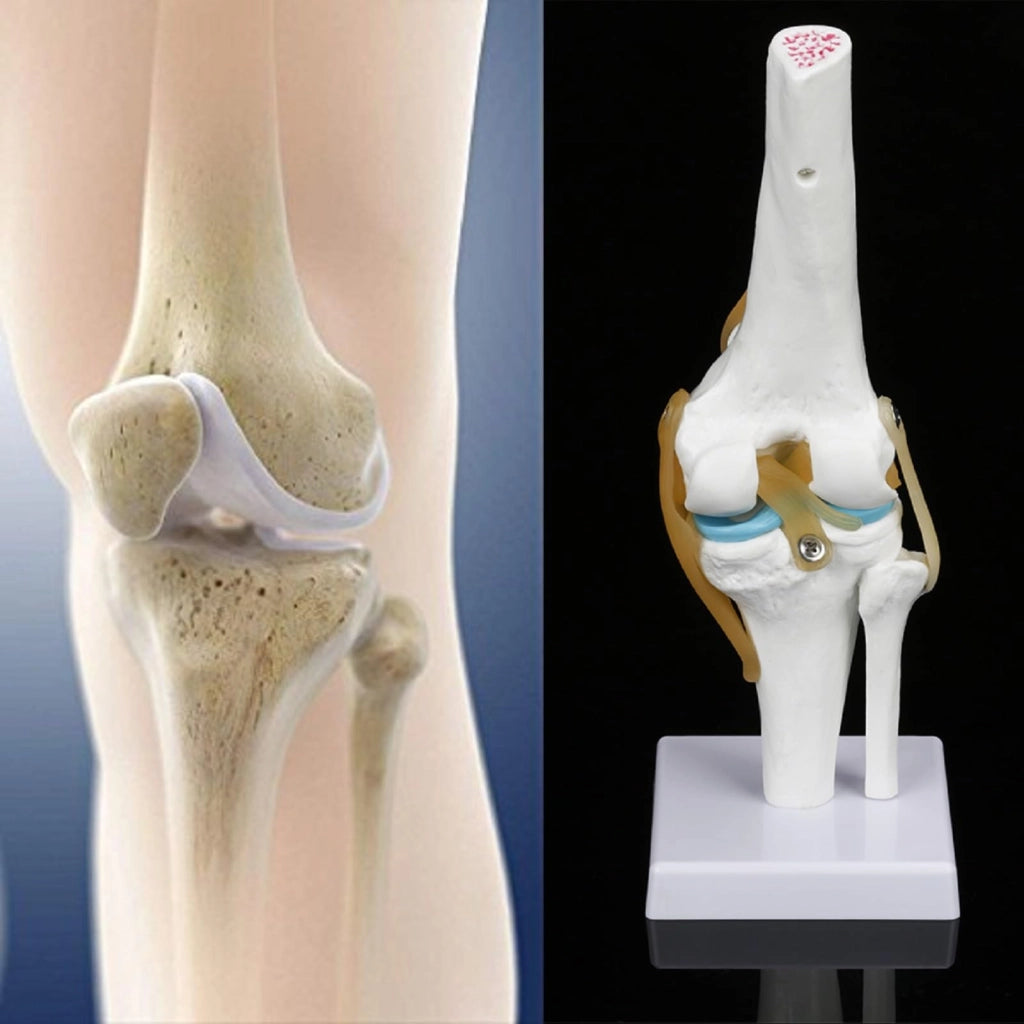 Modello anatomico del ginocchio, a grandezza naturale, completo di legamenti