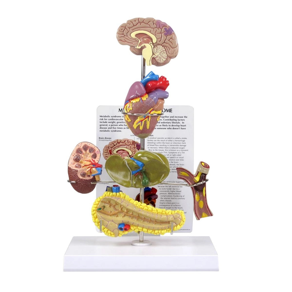 Modello metabolico con organi miniaturizzati, mappa didattica