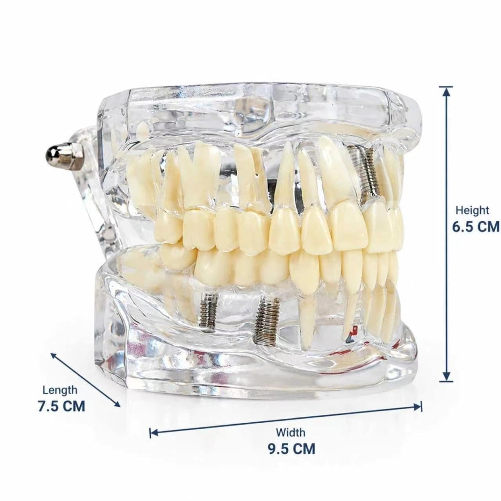 Modello dentale in acrilico trasparente per l'insegnamento e l'igiene orale