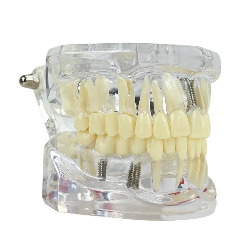 Modello dentale in acrilico trasparente per l'insegnamento e l'igiene orale