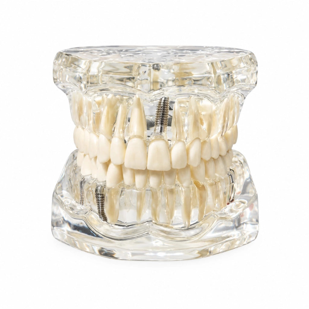 Modello dentale in acrilico trasparente per l'insegnamento e l'igiene orale