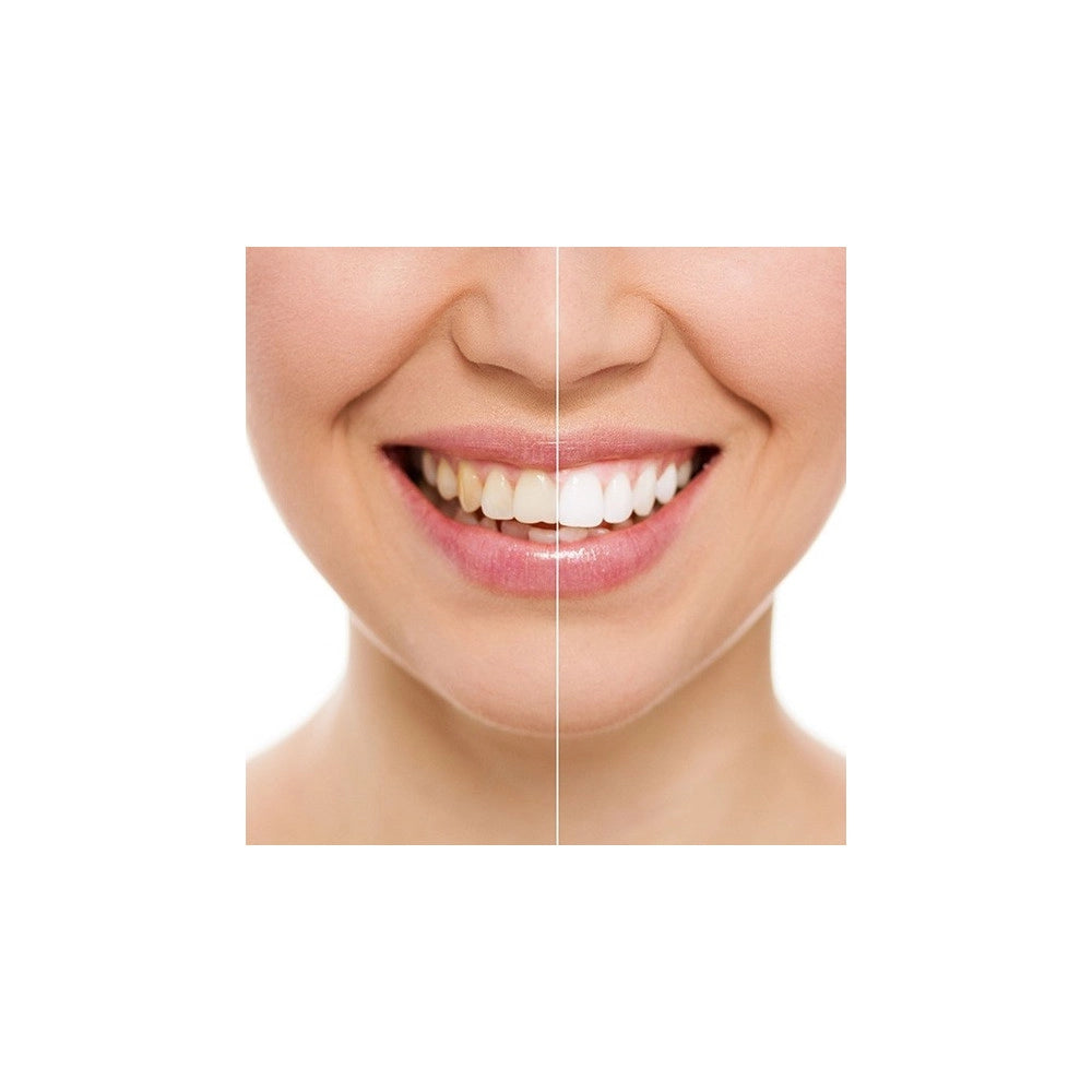 Trade Shop - Dispositivo Professionale Sbiancante A Led Denti Dental White Rx Sorriso Super -