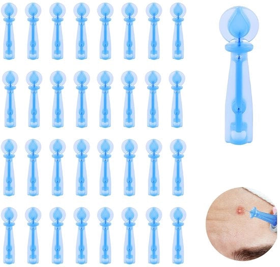 Set di Rimossoressore di Misure Elettriche da 100 Unità - Rimossoressore di Misure Elettriche - Strumento per Rimuovere Acne - Set di Aghi per Acne - Pelle Radiante - Ideale per l'Uso Lungo il Tempo