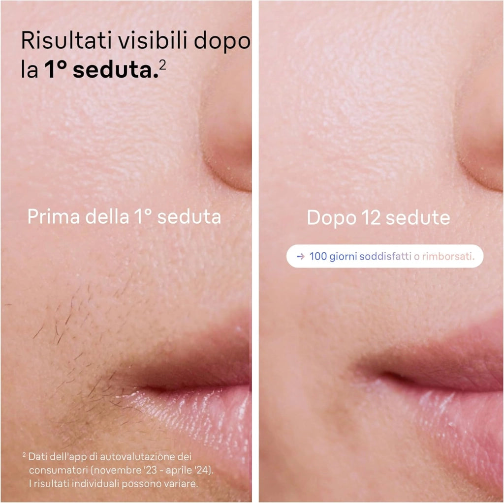 Braun Skin I·Expert Epilatore Luce Pulsata Smart, Depilatore Corpo Donna, Alternativa Laser Peli Donna, Include Pochette, Rasoio Venus, Luce Pulsata Braun, 4 Testine Viso E Corpo, PL7387