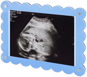 Lettore di foto magnetico 18x13cm - Acrilico - Annuncio di maternità - Regalo per futuri genitori - Materiale duraturo