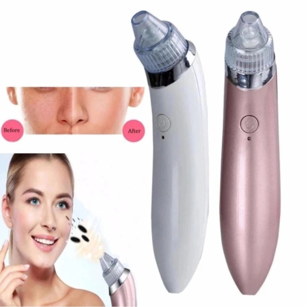 Trade Shop - Aspiratore Rimuovere Punti Neri Ad Ultrasuoni Pulizia Viso Facciale Portatile -