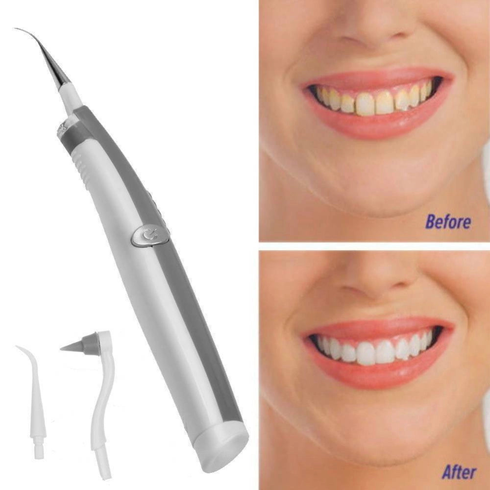 Trade Shop - Pulizia Denti Ad Ultrasuoni Con Led A Batterie Rimozione Tartaro Placca Macchie -