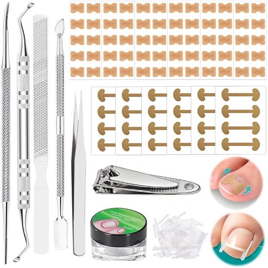 Set di correzione unghie per adolescenti 139 pezzi - Set di correzione unghie per adolescenti - Strips di cura unghie - Nagelknipper - Strisce di sicurezza - Strisce di sicurezza - Set di correzione unghie