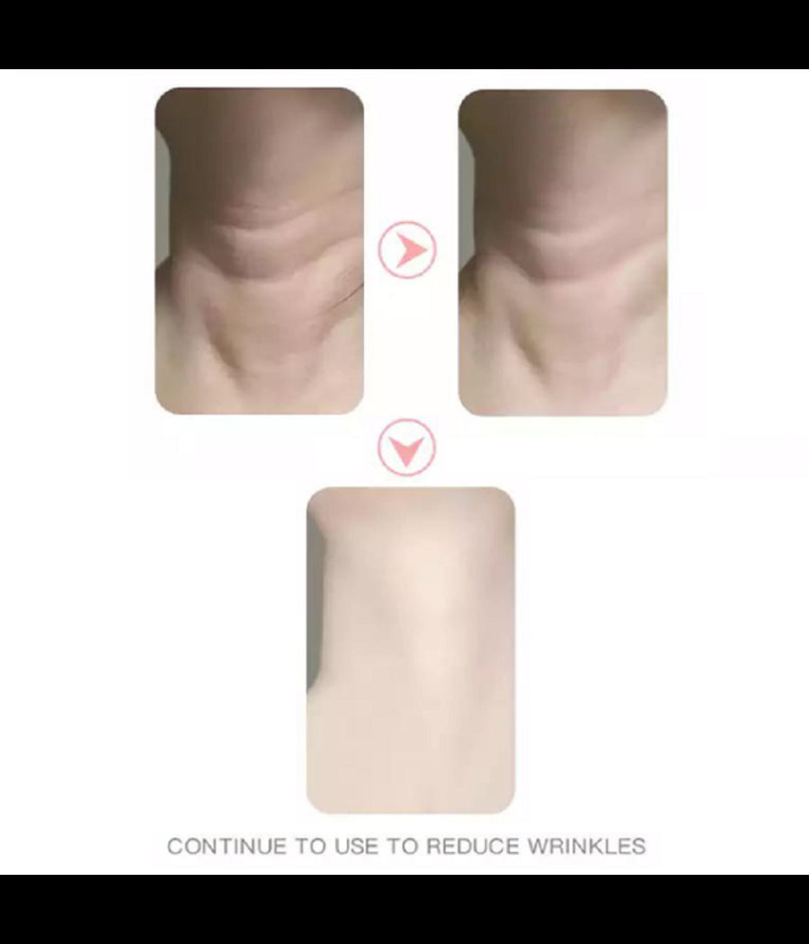 Dispositivo Massaggiatore Di Bellezza Antietà  Per Collo Viso Ricaricabile Q-mj10         