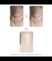 Dispositivo Massaggiatore Di Bellezza Antietà  Per Collo Viso Ricaricabile Q-mj10         