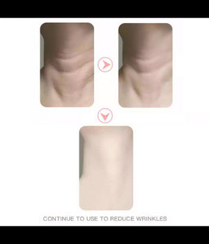 Dispositivo Massaggiatore Di Bellezza Antietà  Per Collo Viso Ricaricabile Q-mj10         