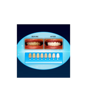 Dispositivo Professionale Sbiancante A Led Denti Dental White Rx Sorriso Super         