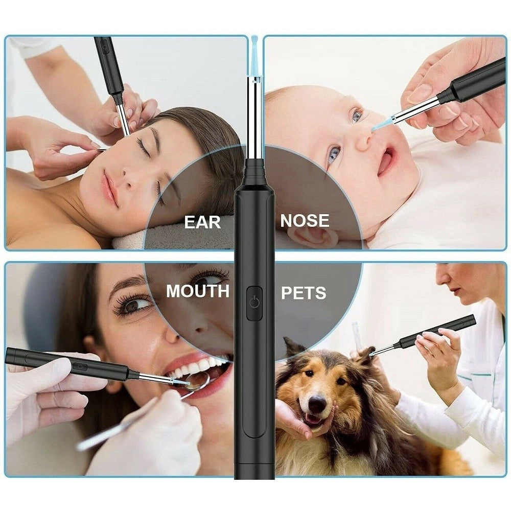 Trade Shop - Otoscopio Ispezione Orecchio Kit Rimozione Cerume Wifi Microscopio Camera Q-es1 -