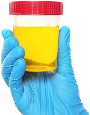 4 Pz CONTENITORI URINE 120 ml STERILE CON TAPPO ERMETICO A VITE