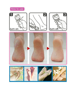 Epilatore Rasoio Elettrico Ricaricabile 3in1 Donna Corpo Pedicure Lima Gm-3052         