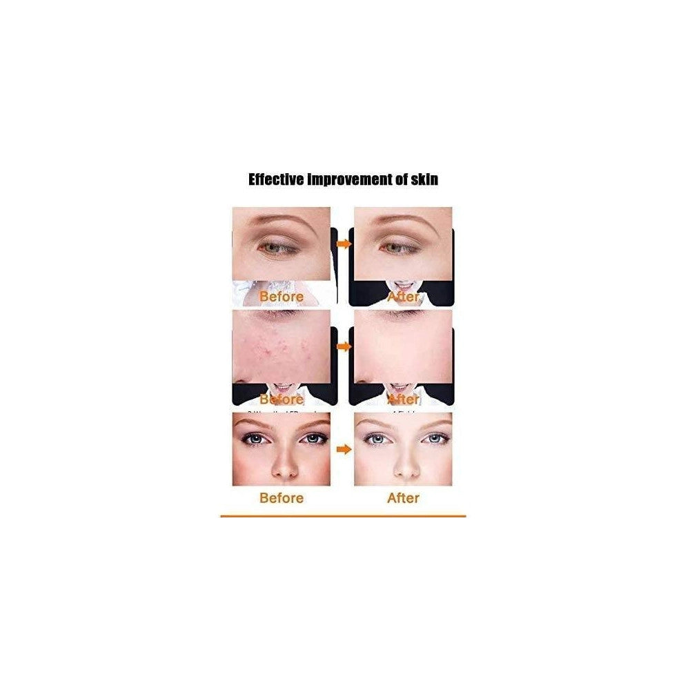 Trade Shop - Maschera Viso Fototerapia Spettro Bellezza Acne Pelle Anti Rughe Radiofrequenza -