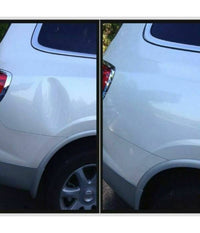 Kit 28 Pz Riparazione Ammaccature Botte Auto Tira Bolle Bozze Senza Verniciatura         