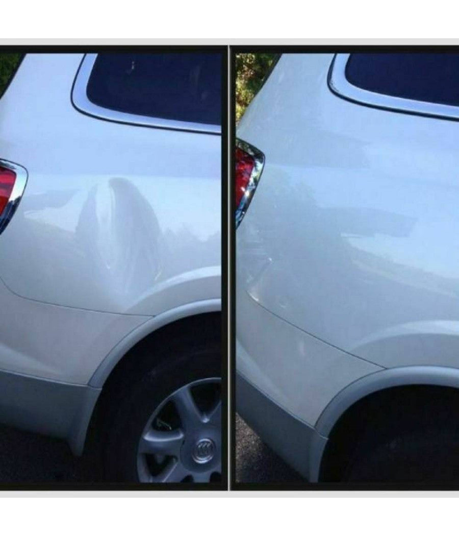 Kit 28 Pz Riparazione Ammaccature Botte Auto Tira Bolle Bozze Senza Verniciatura         