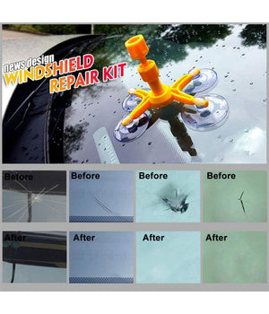 Kit Di Riparazione Parabrezza Per Auto Set Strumenti Fai Da Te Vetro Con Resina         