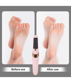 Pedicure A Batteria Ricaricabile Elimina Calli Rimuovi Duroni Piedi Esfoliante         