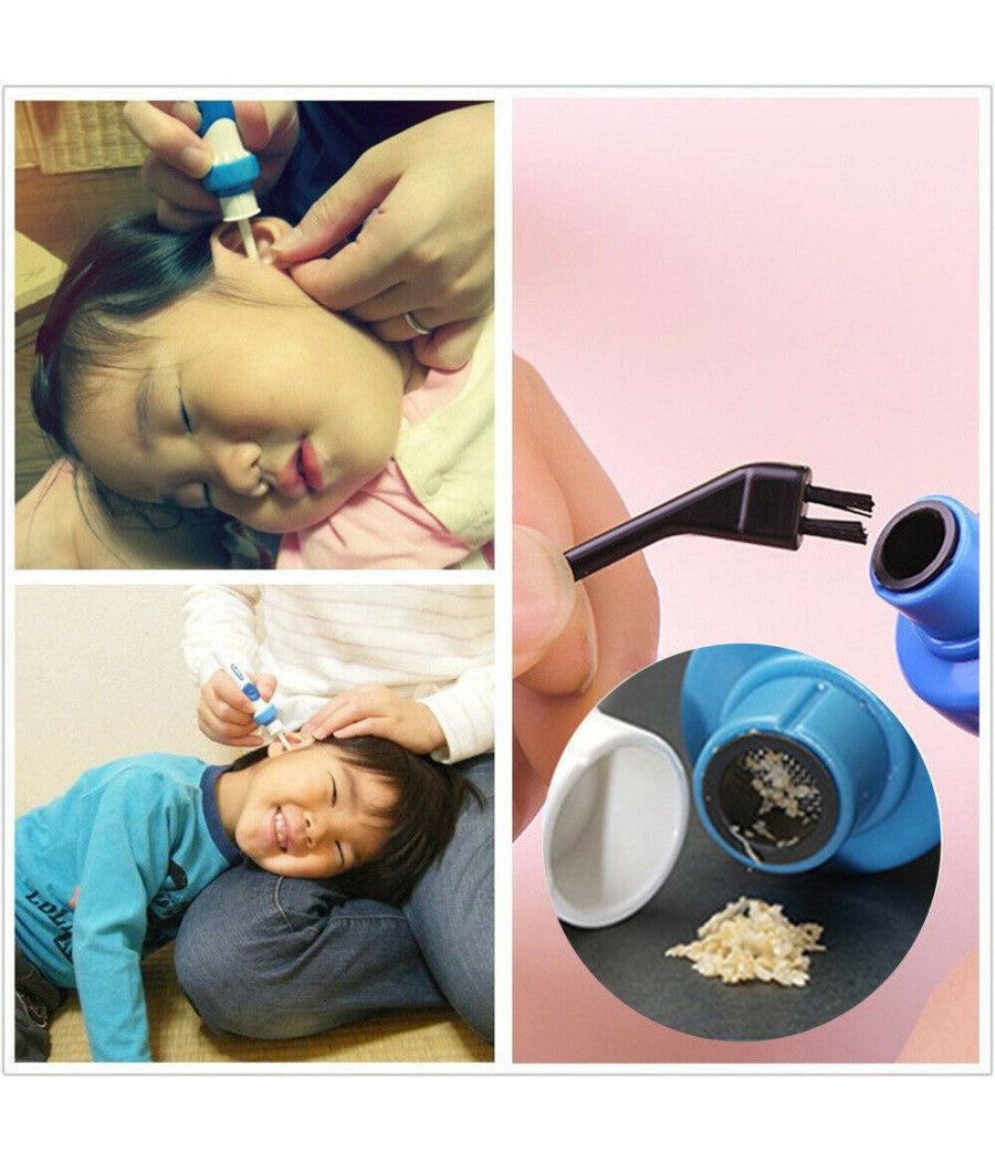 Pulisci Orecchie Aspira Elimina Rimuovi Leva Pulizia Cerume A Batterie Indolore         