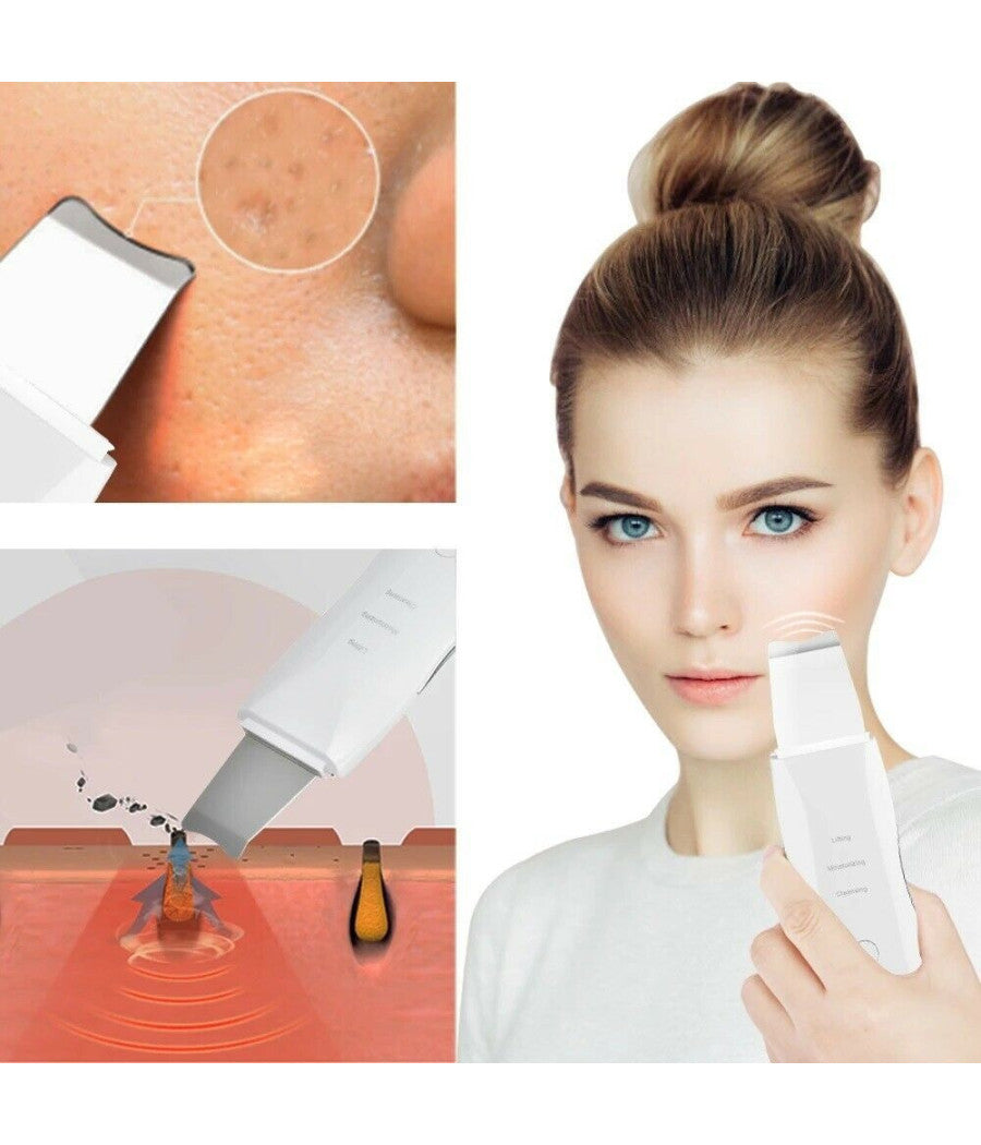 Spatola Ultrasuoni Pulizia Viso Pelle Elimina Punti Neri 3 Funzioni         